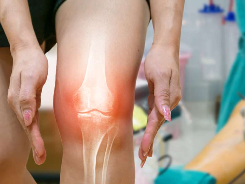 世界關節炎日丨只差一個字的兩種關節炎，區別居然這么大！