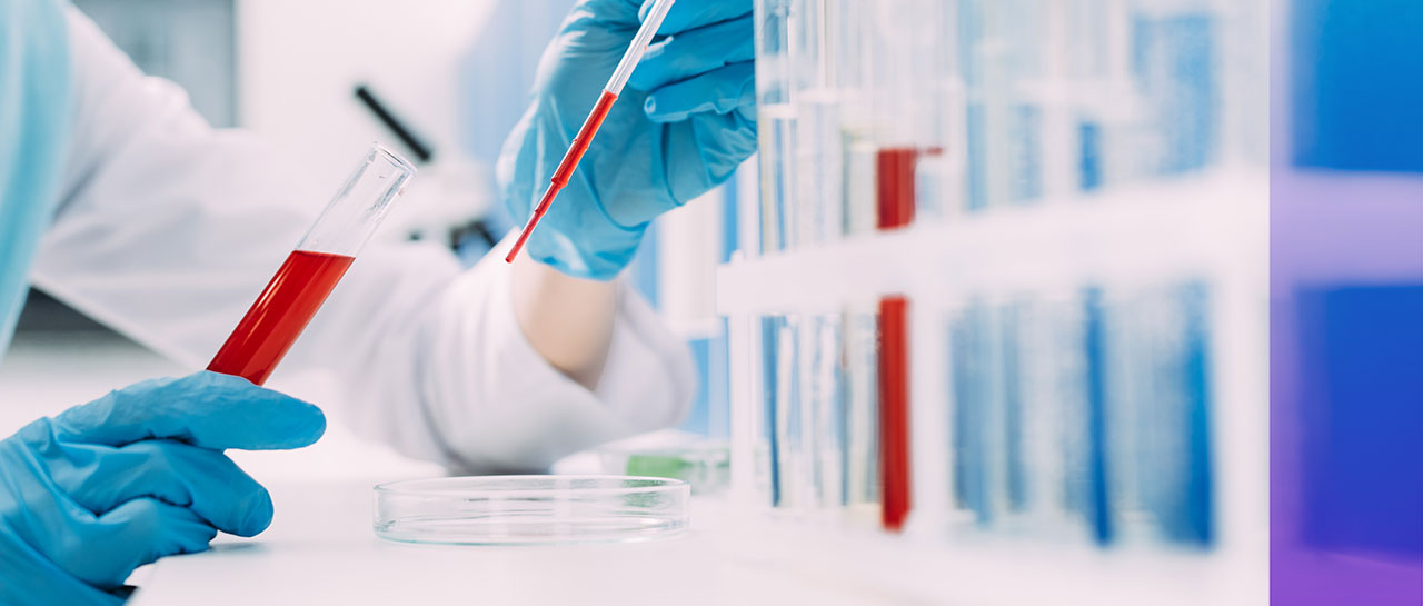 最新研究丨華西醫院：對麗珠DLCM技術平臺檢測ANCA相關血管炎的診斷評價