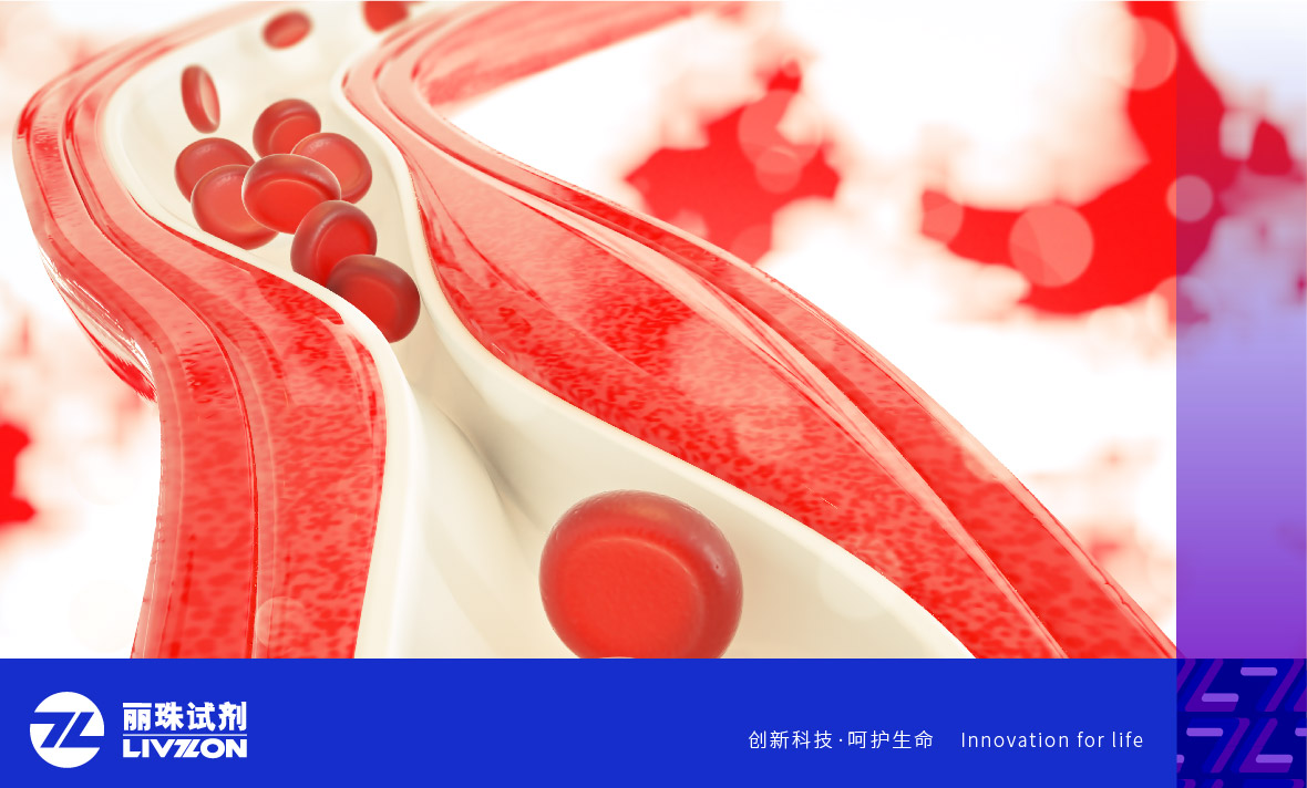 麗科普丨抗磷脂抗體陽性能診斷為「 抗磷脂綜合征 」嗎？